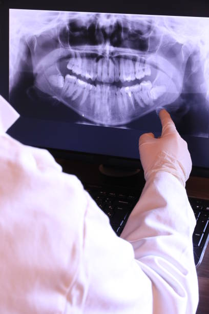 Best Root Canal Emergency Dentist  in Mount Morris, MI