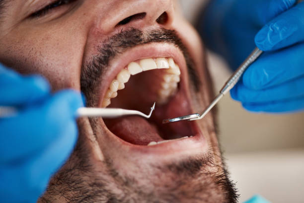 Best Emergency Dentist Near Me  in Mount Morris, MI