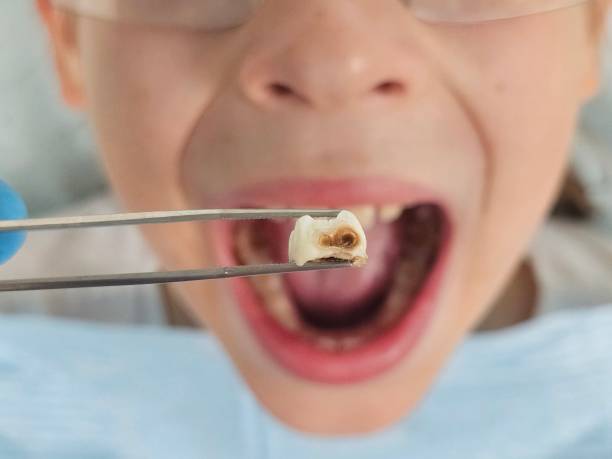 Best Emergency Tooth Extraction  in Mount Morris, MI